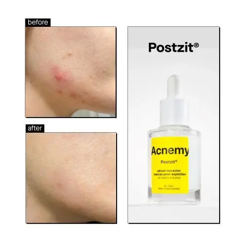 Postzit Zit Marks Solutions - Image 3