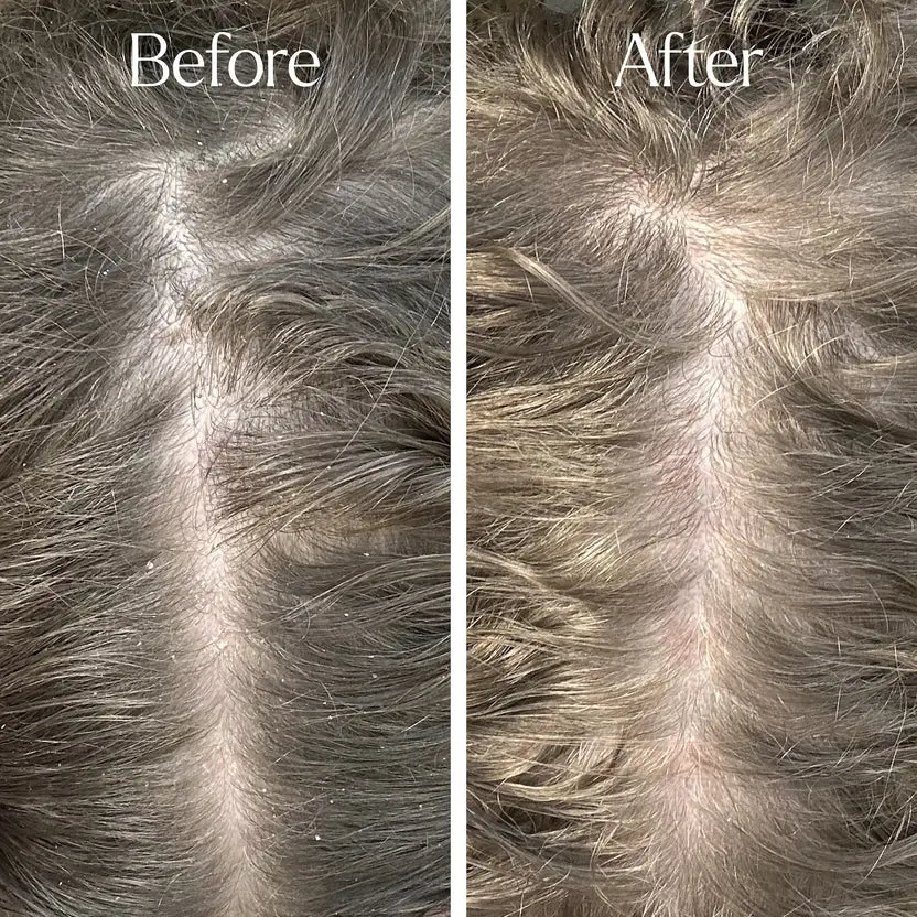 Detox Clarifying Shampoo - Image 2