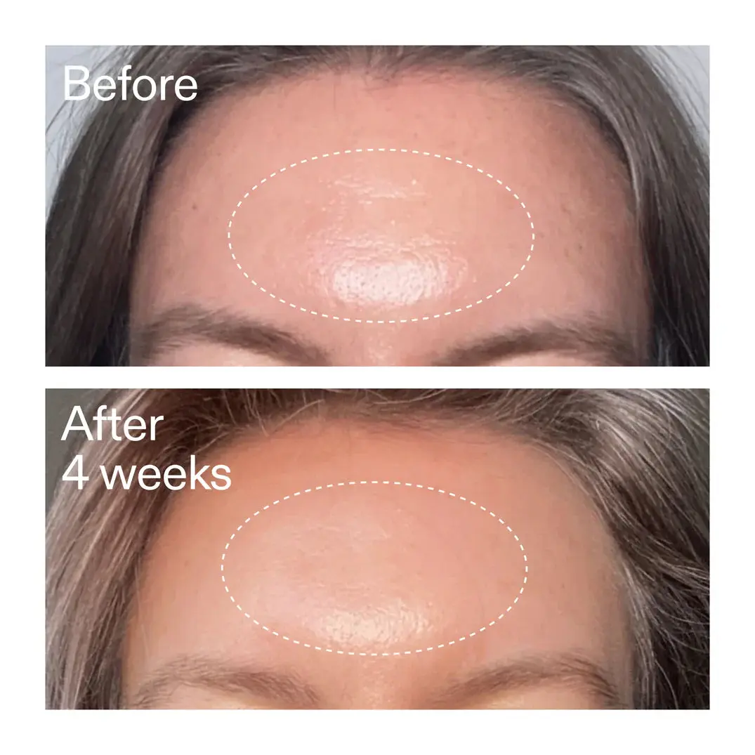 Advanced Retinoid Serum - Image 3
