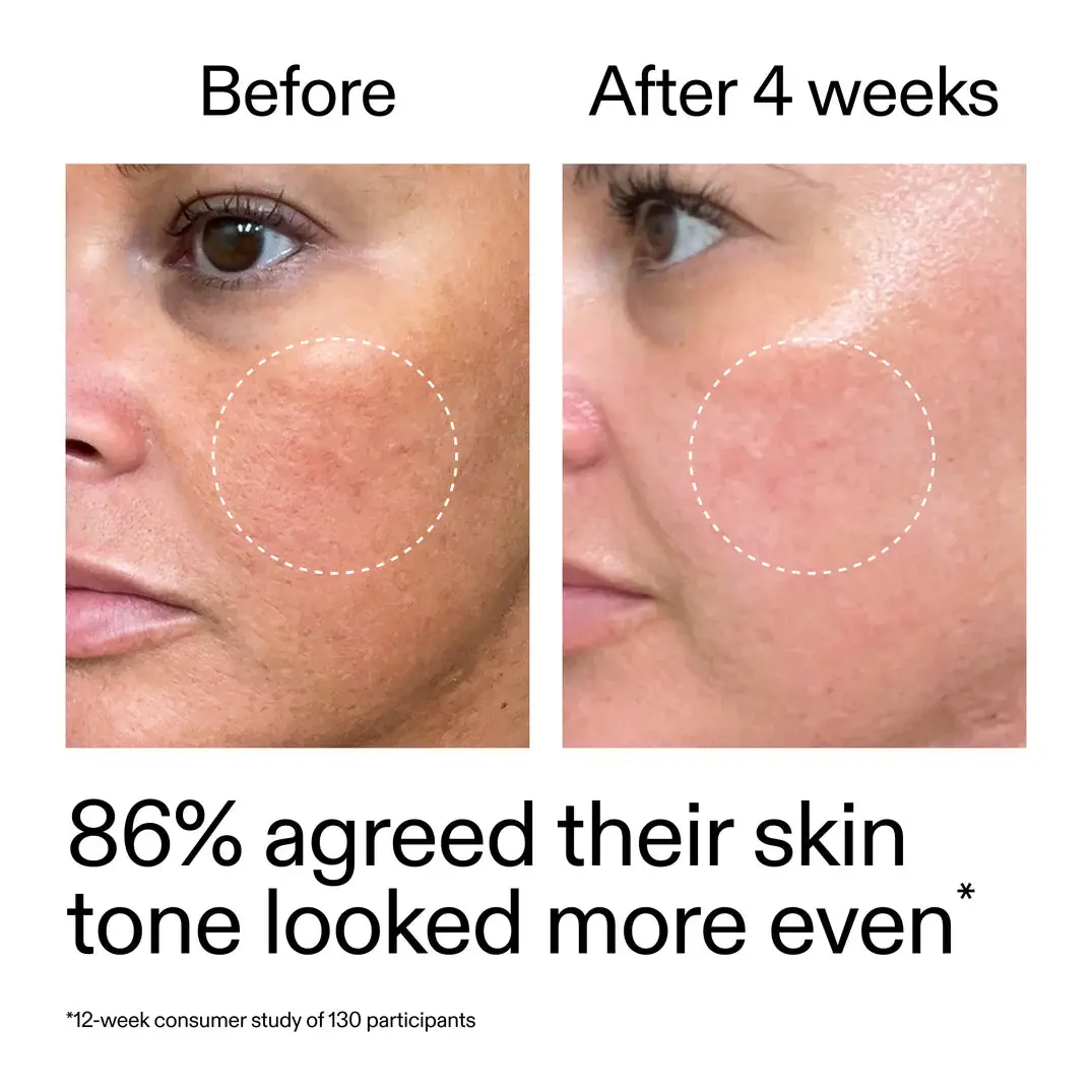 Starter Retinol Serum - Image 2
