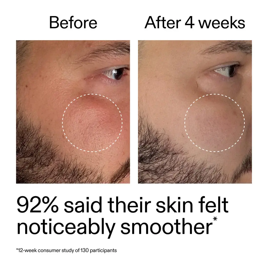 Starter Retinol Serum - Image 4
