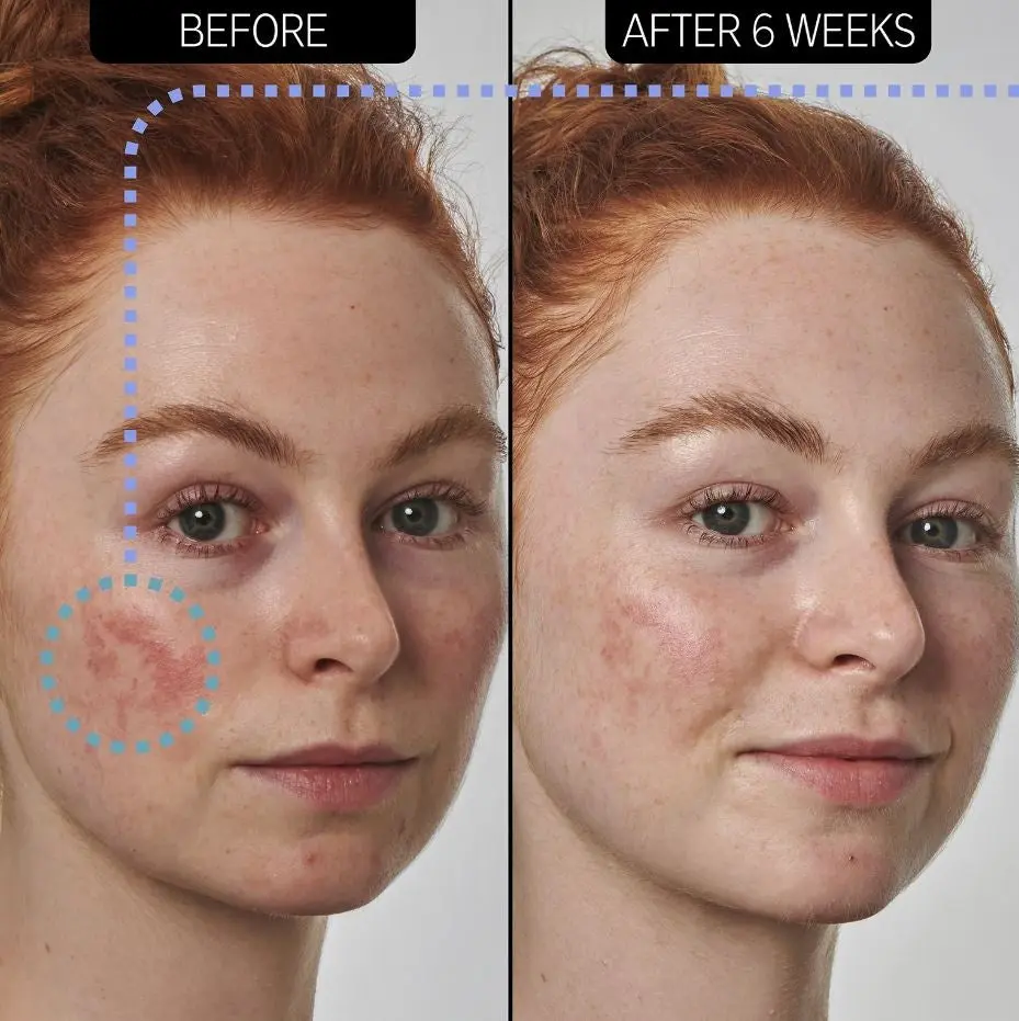 SuperSolutions Redness Relief Solution - Image 3