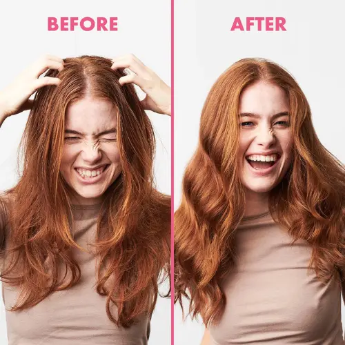 Scalp Refresh Dry Shampoo Anti Dandruff - Image 2